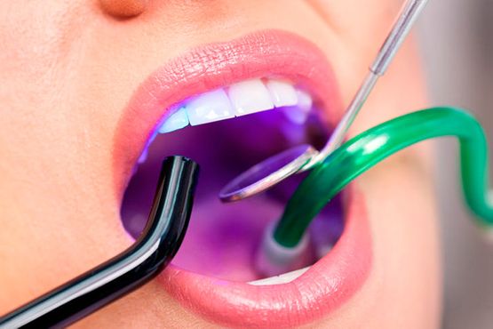 Clínica dental Alcadent revisión dental