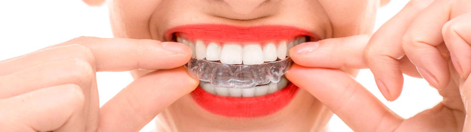 Clínica dental Alcadent banner 1